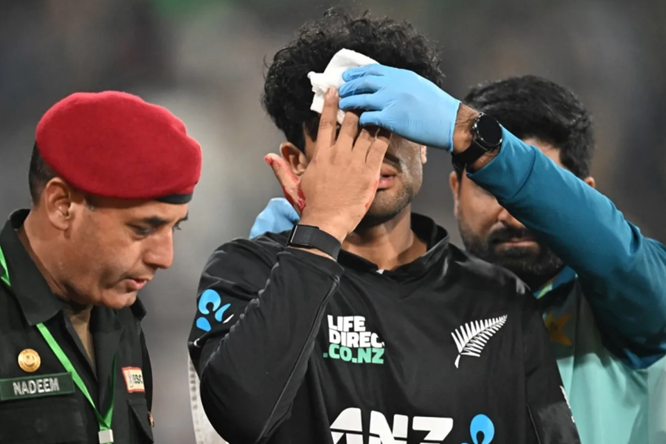Watch: Rachin Ravindra bleeds after head blow while fielding